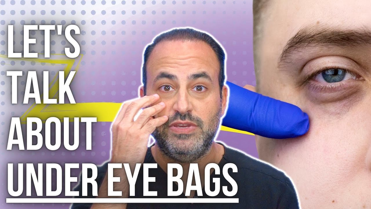 Types and Causes of Under Eye Bags | Lesson of the Day