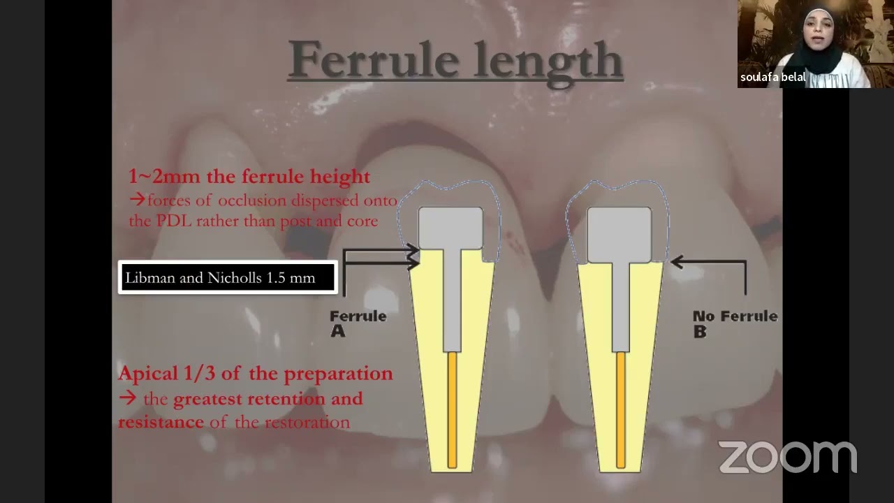Functional Crown Lengthening with Dentists Cafe