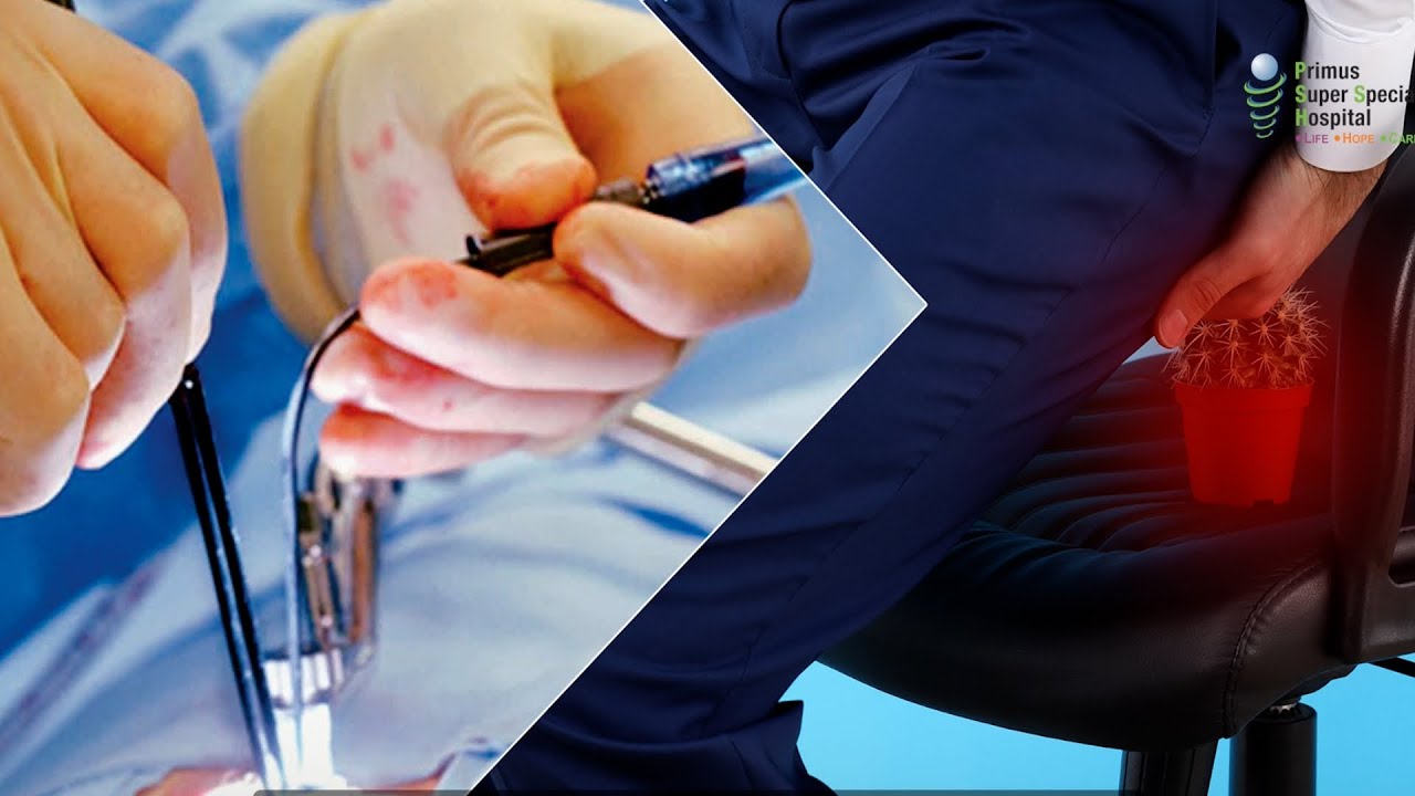 🎥 Understanding Common Anorectal Disorders: Piles, Fissure & Fistula