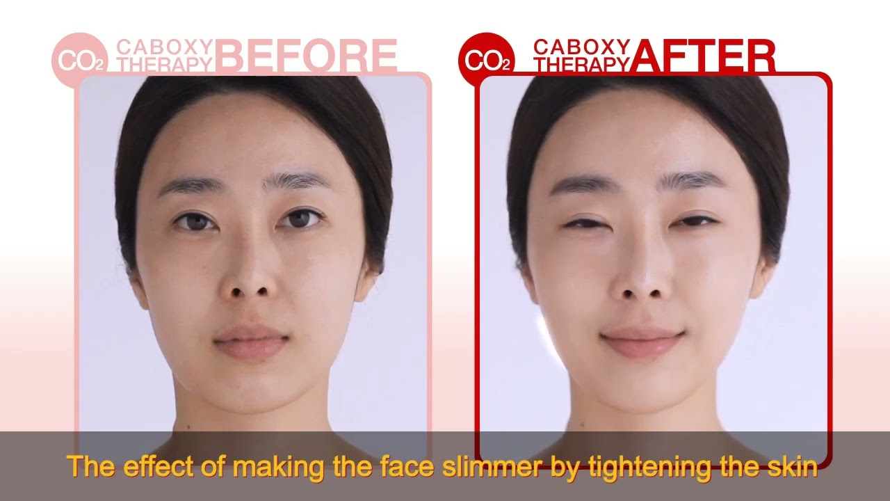 Carboxy mask pack _ How to use _ Short version _ Daejong Medical Korea