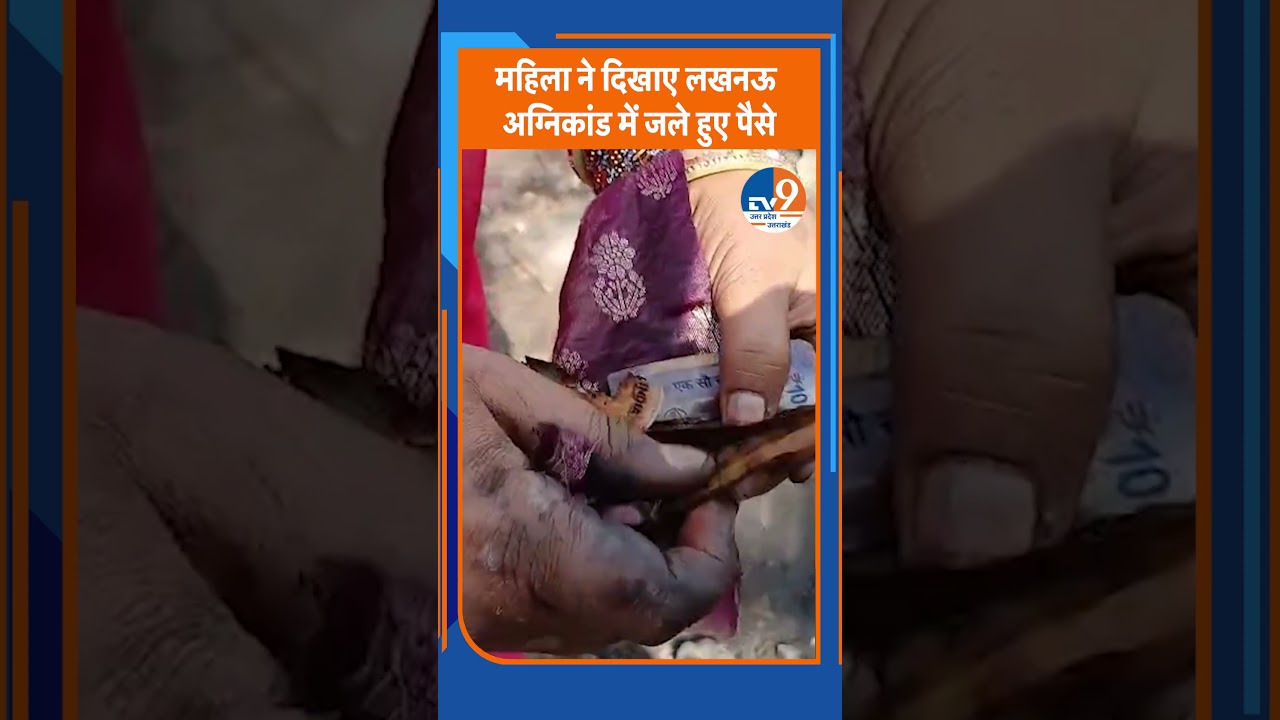 Lucknow Vikas Nagar Fire: 50 से ज्यादा झुग्गियां जलकर राख, महिला ने दिखाए जले हुए नोट