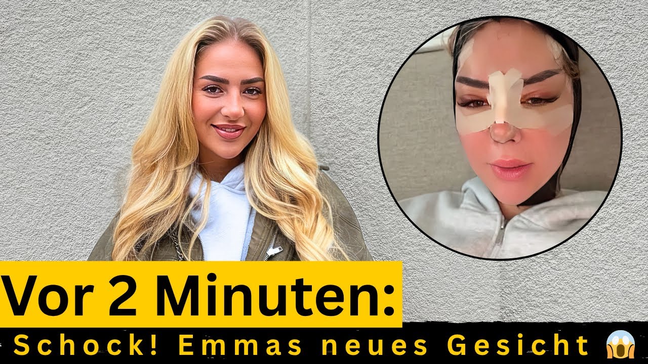 Emma Fernlund: Neues Gesicht schockiert Fans &ndash; Kaum wiederzuerkennen!