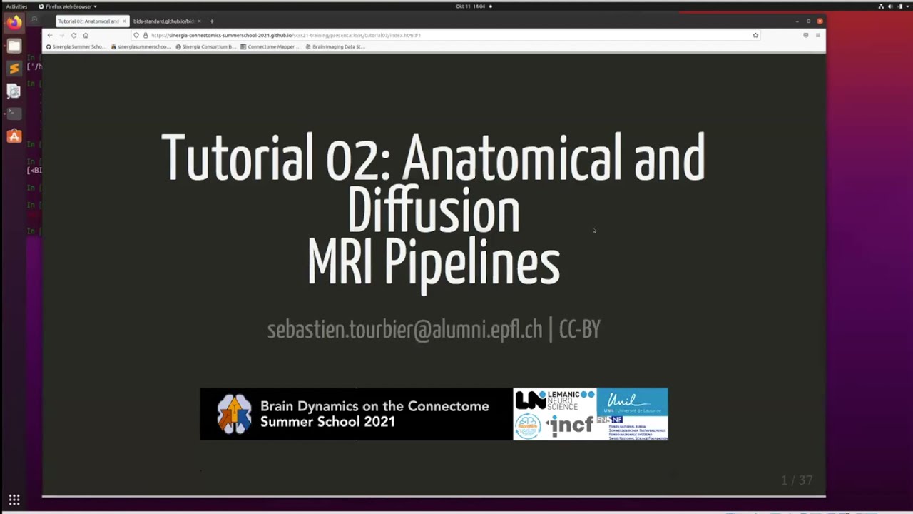 Tutorial 2   Anatomical and Diffusion pipelines   Sebastien Tourbier
