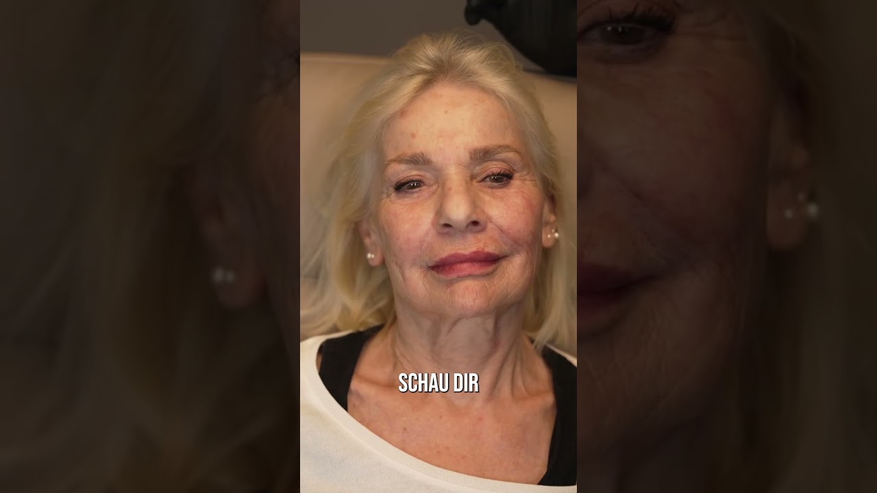 Liquid Facelift/Fullface Behandlung bei DR. NICK!