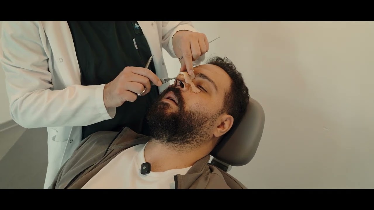 Burun Ameliyatı: Adım Adım Süreç