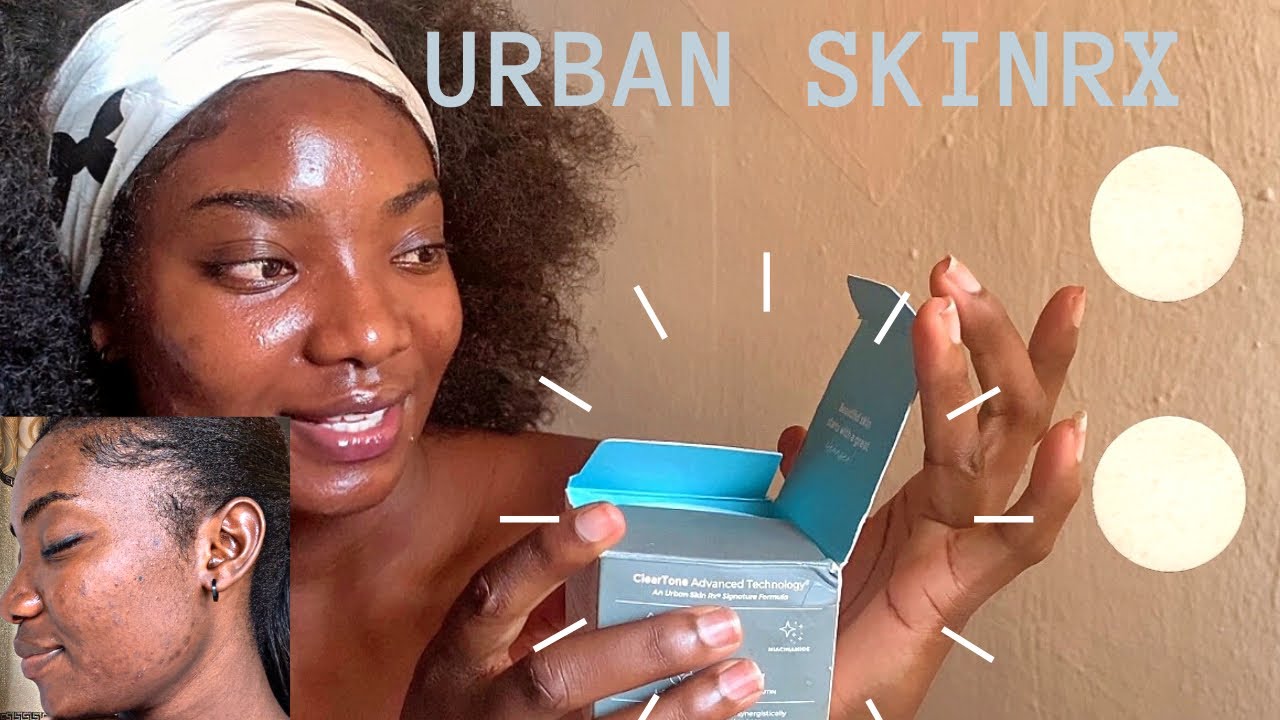 Does  the Urban skin rx clear skin cleansing bar really work on hyper pigmentation? @UrbanSkinRx