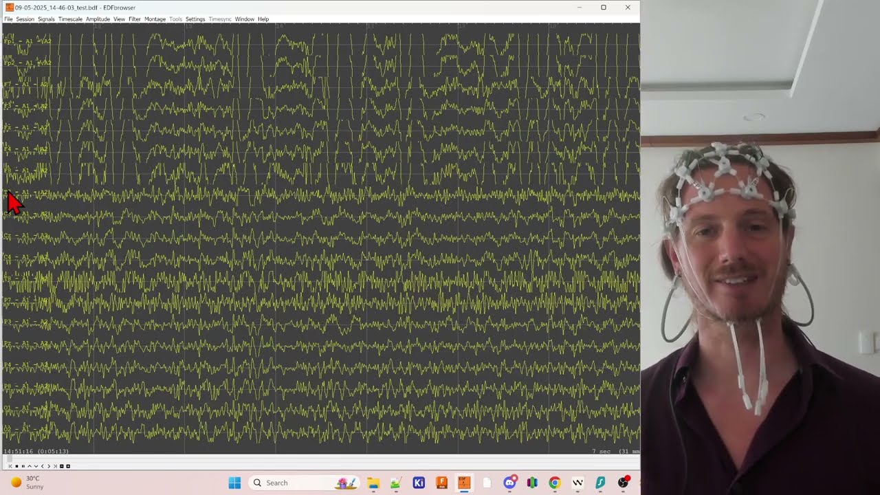 Preparing the headset and getting good signal quality
