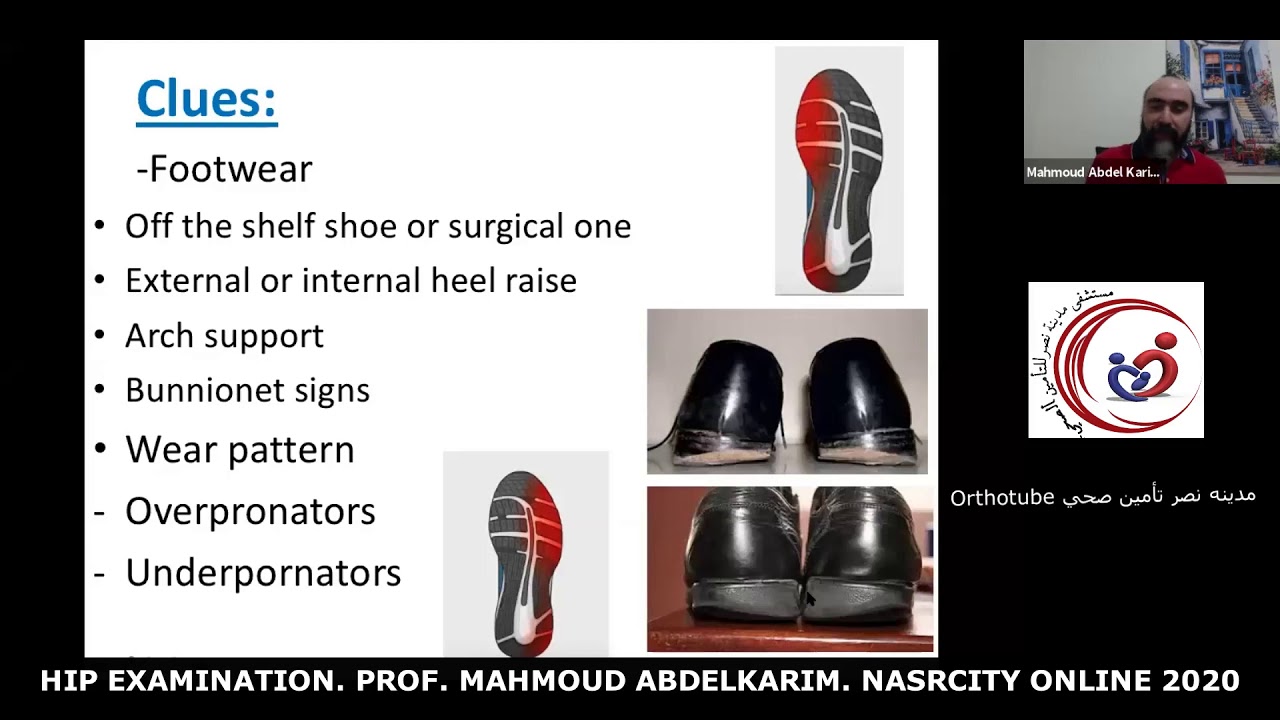 Hip examination. Prof. Mahmoud Abdelkarim. nasrcity covid19 online lectures 2020