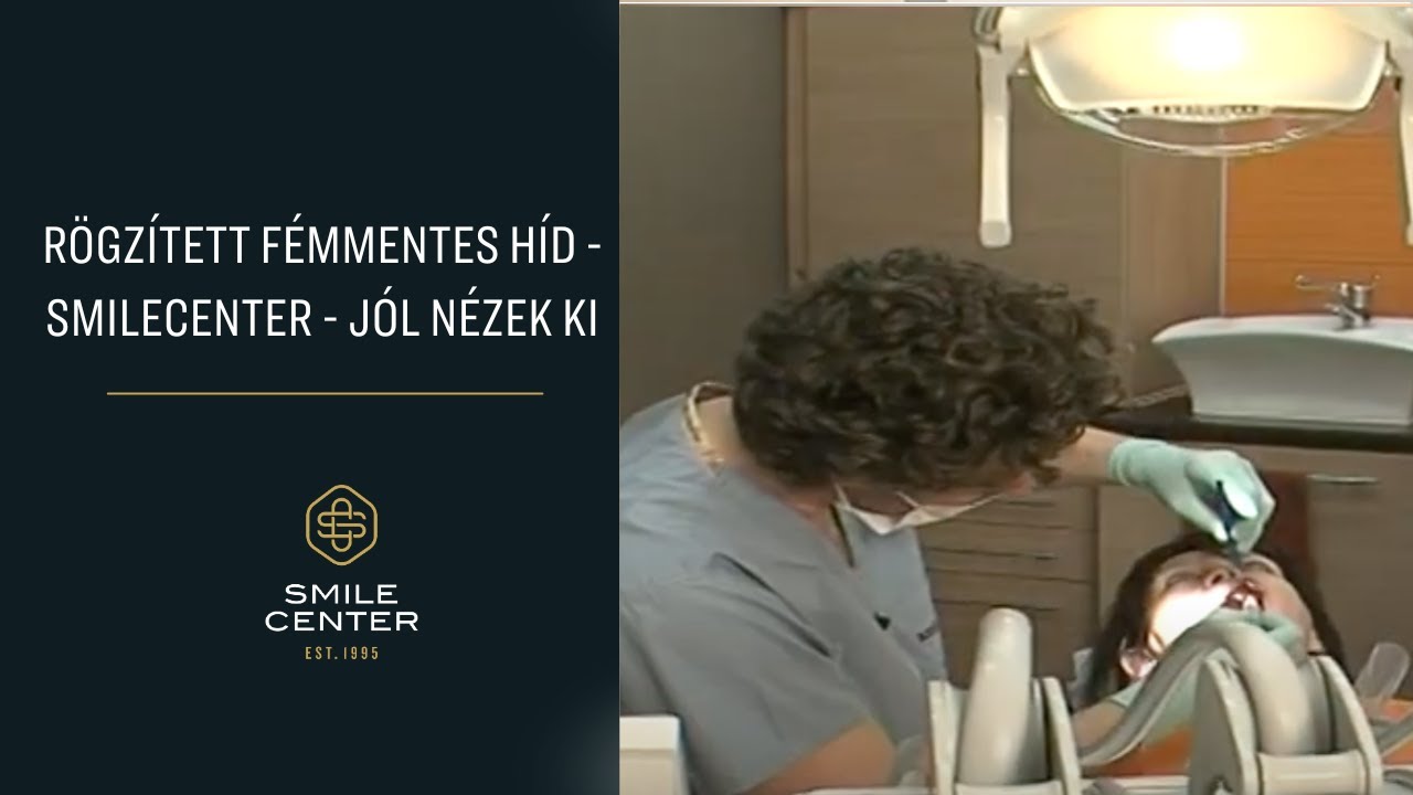 Rögzített fémmentes híd -  SmileCenter -  Jól nézek ki