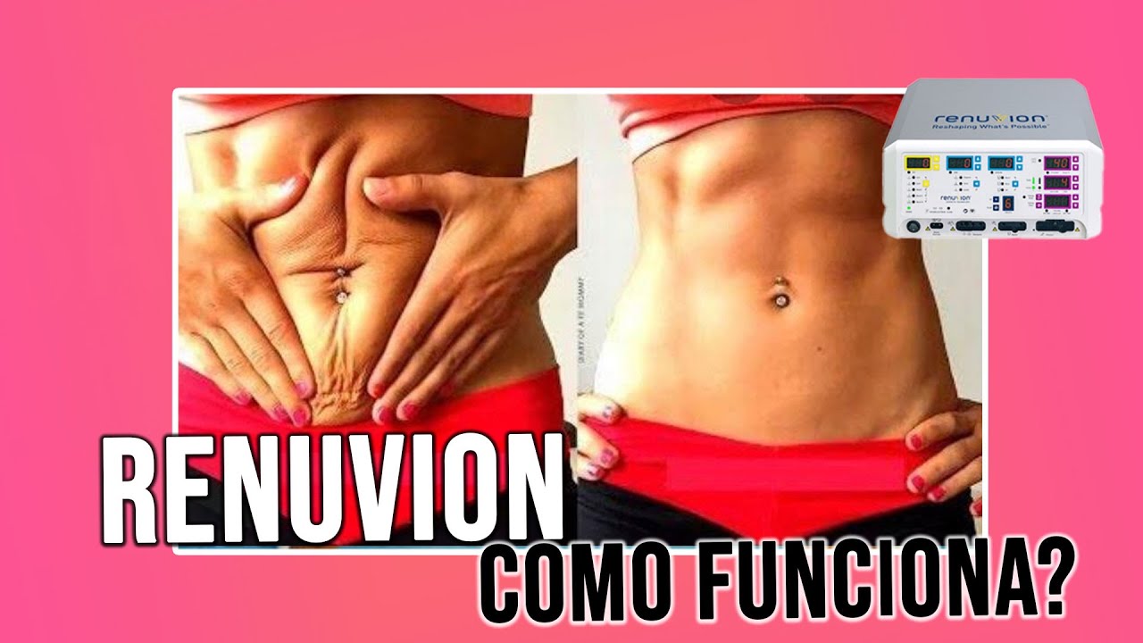 RENUVION COMO FUNCIONA? FLACIDEZ DE PELE