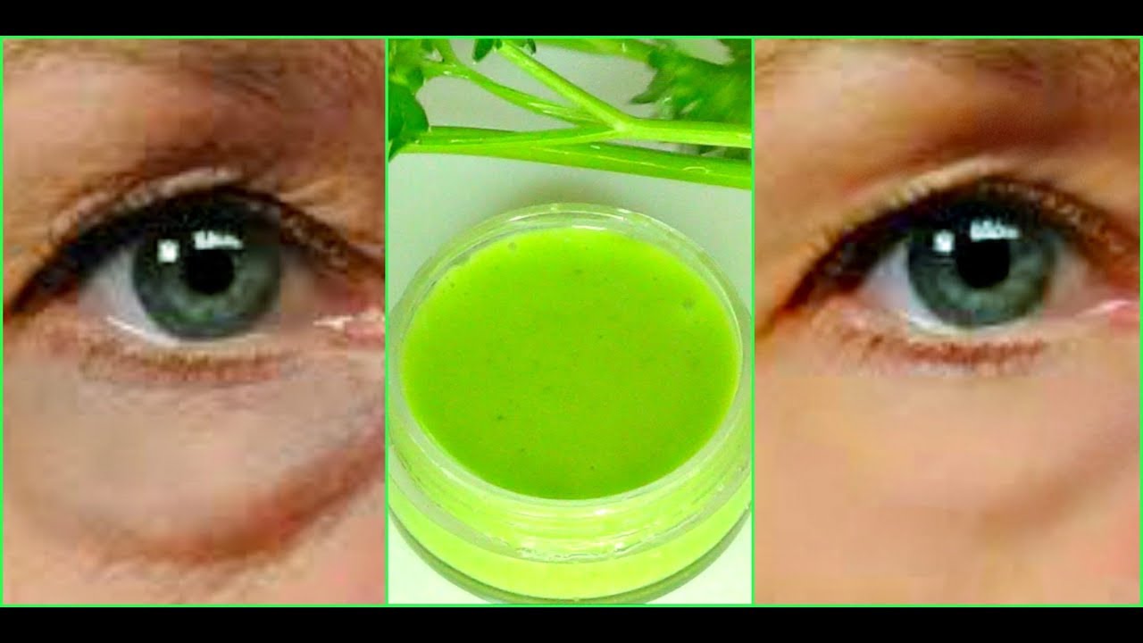 APPLY AT NIGHT GET RID OF DARK CIRCLES, EYE BAGS, WRINKLES AND FINE LINES FAST |Khichi Beauty