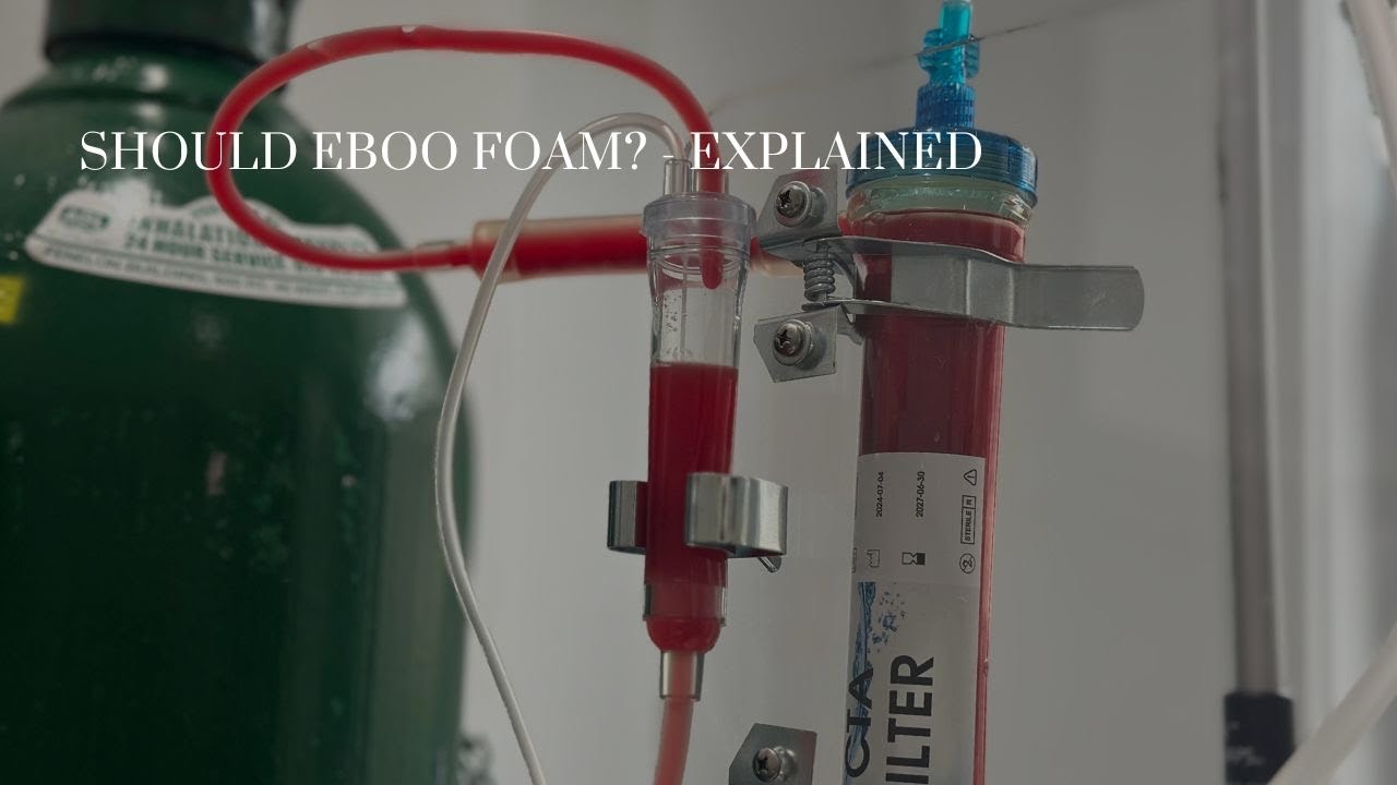Should EBOO Foam? - Explained