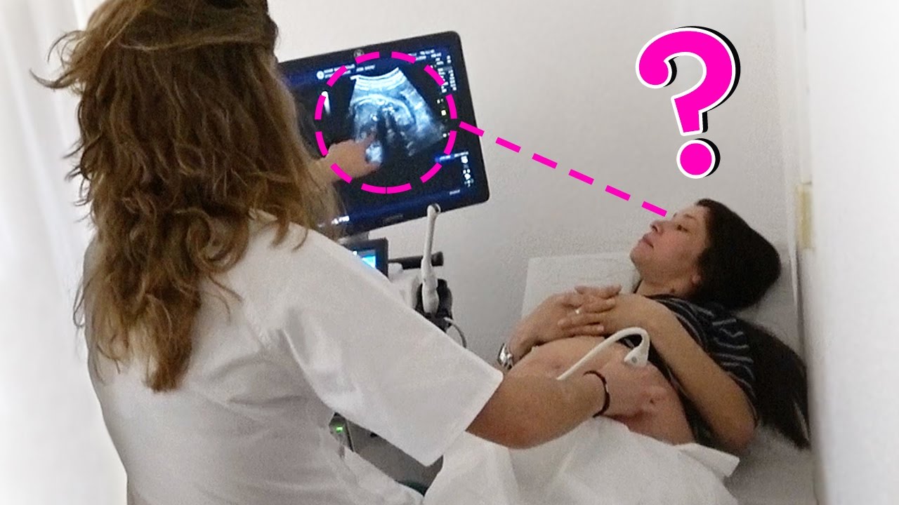 ÚLTIMO ULTRASSOM ANTES DA BEBÊ LAURA NASCER!! Diário de Gravidez