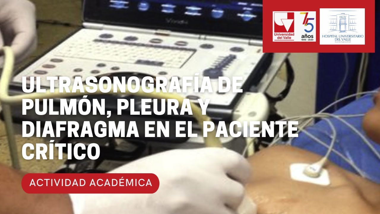 Ultrasonografía de pulmón, pleura y diafragma en el paciente crítico  Aplicaciones y Evidencia Actua