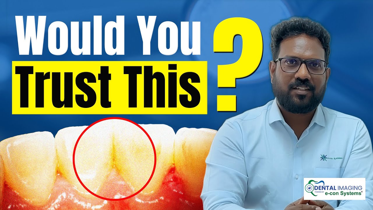Why Image Quality Matters in Intraoral Cameras | Dental Imaging Series &ndash; EP 1 | e-con Systems