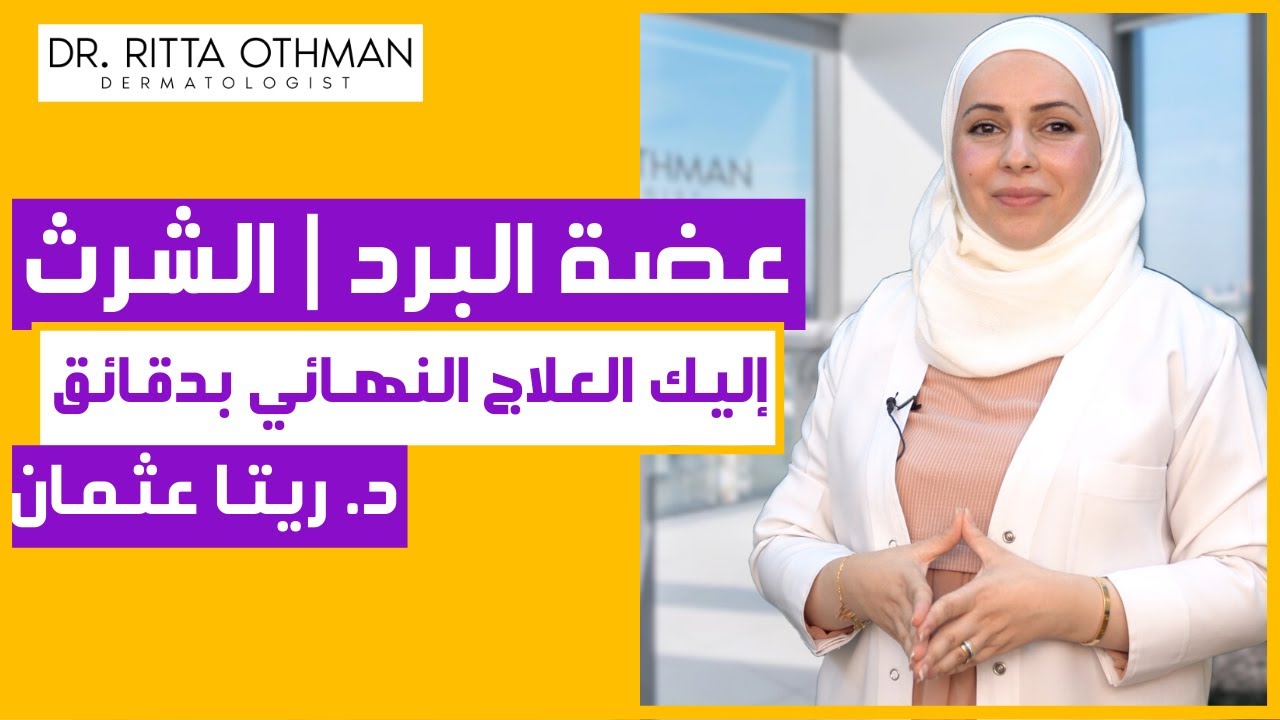 ✅ الشرث | عضة البرد | عضة الصقيع | العلاج الأفضل على الإطلاق