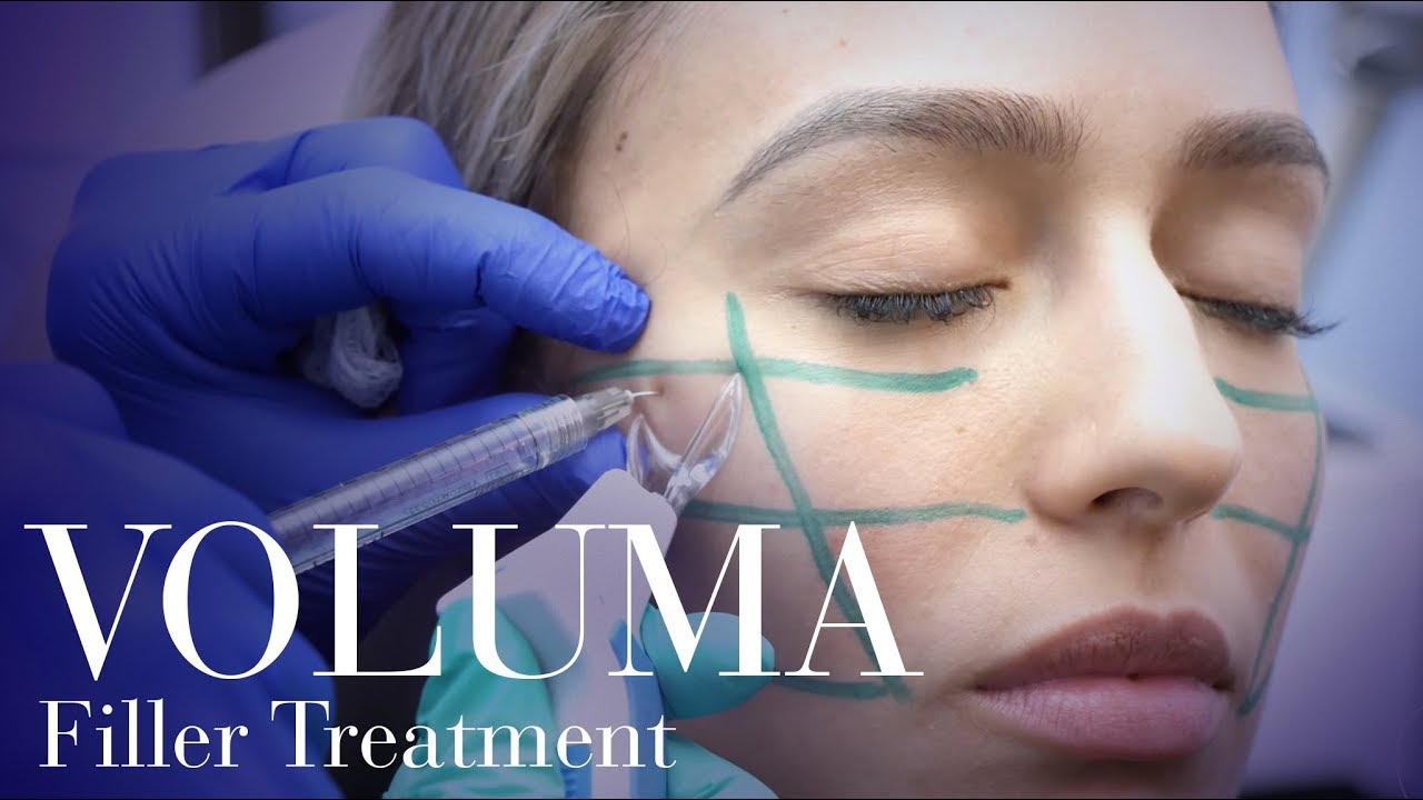 Runway Cheeks! Voluma Cheek Filler