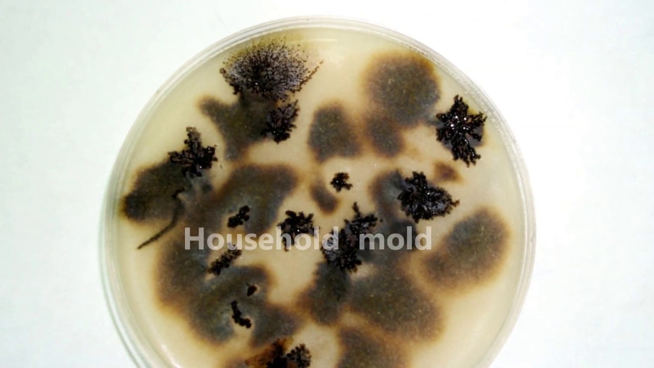 Facts and images of toxic household mold under a microscope