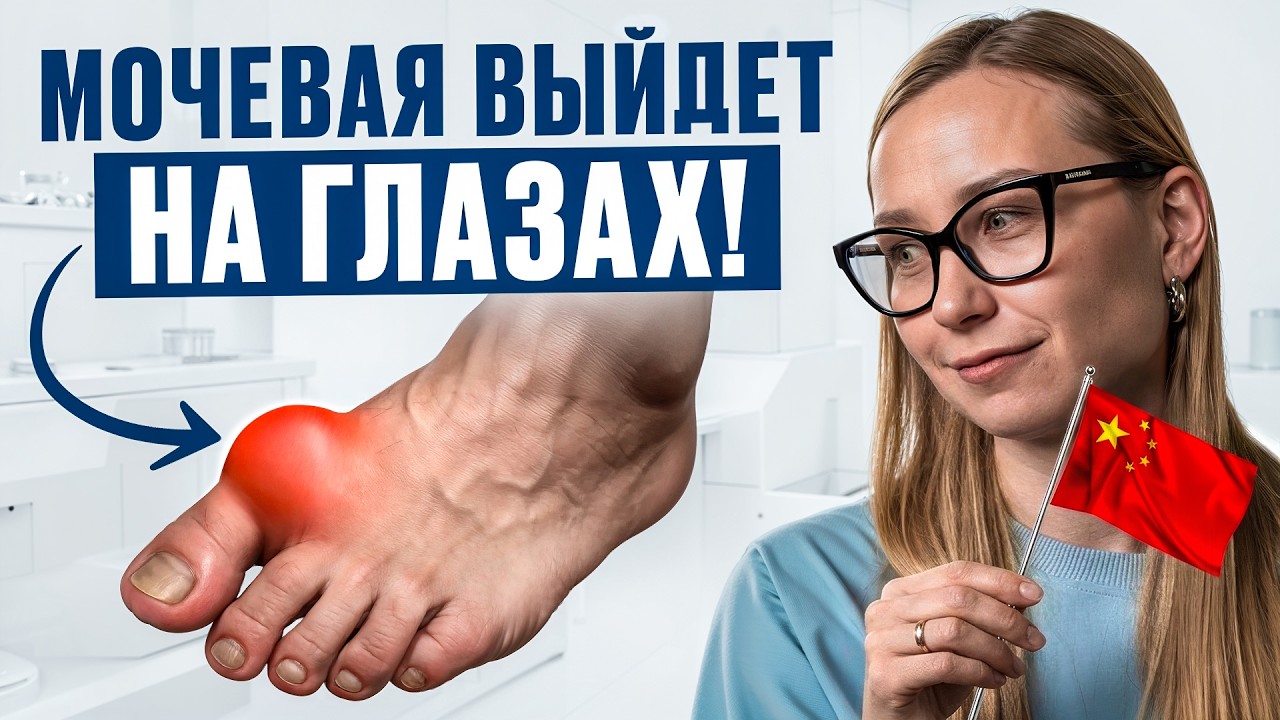 Кто бы мог подумать, что ПОДАГРА боится обычной... Как избавиться от ПРИСТУПОВ подагры?