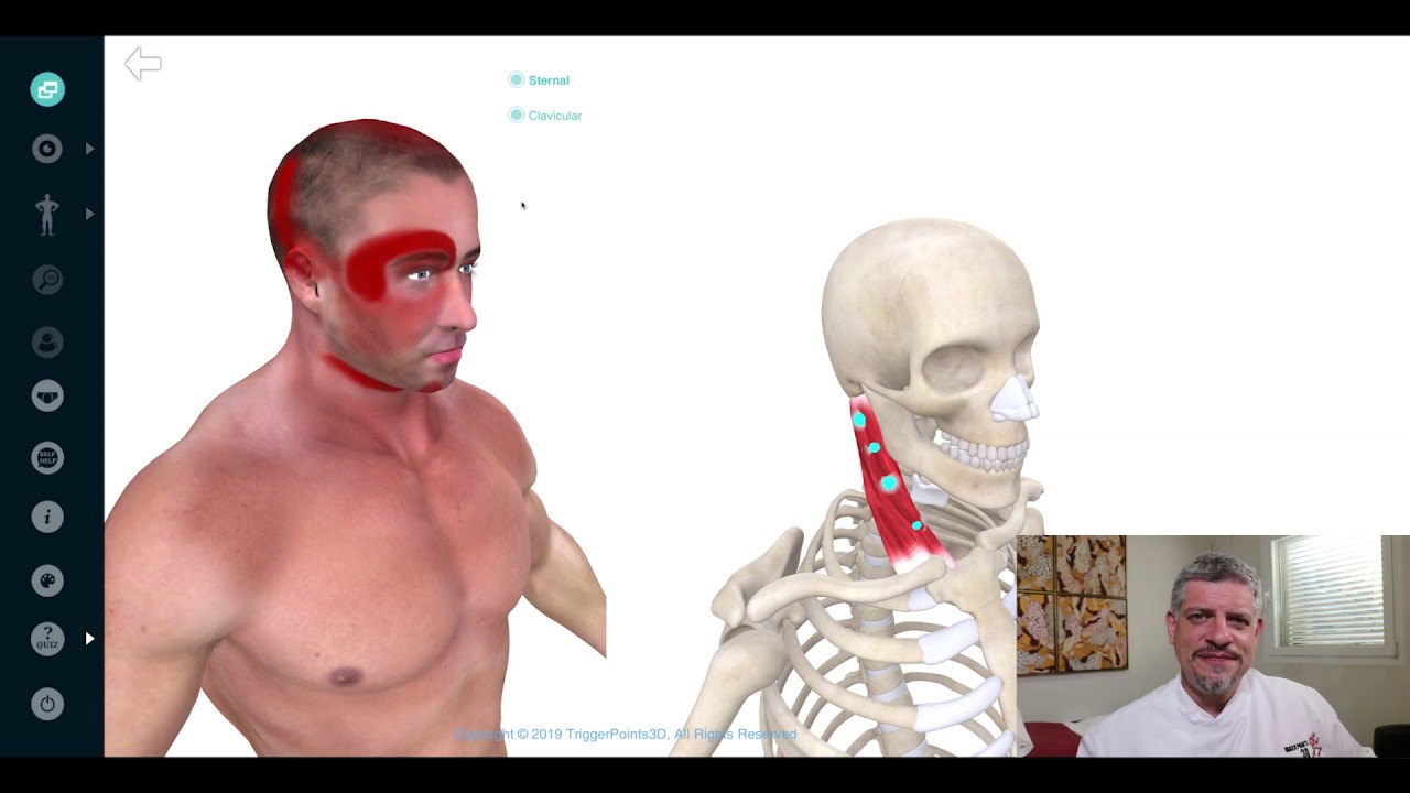Sternocleidomastoid - Trigger Point of the Week