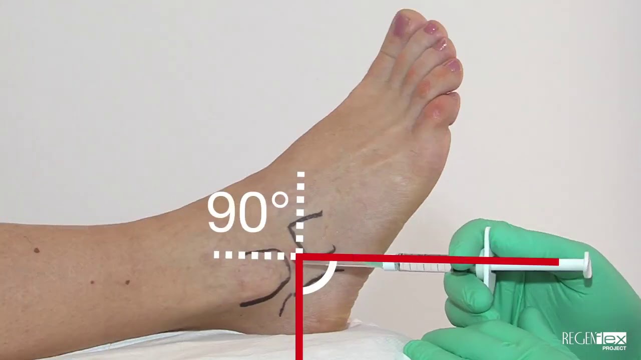 Eklem içi Enjeksiyon Uygulama eğitim videosu