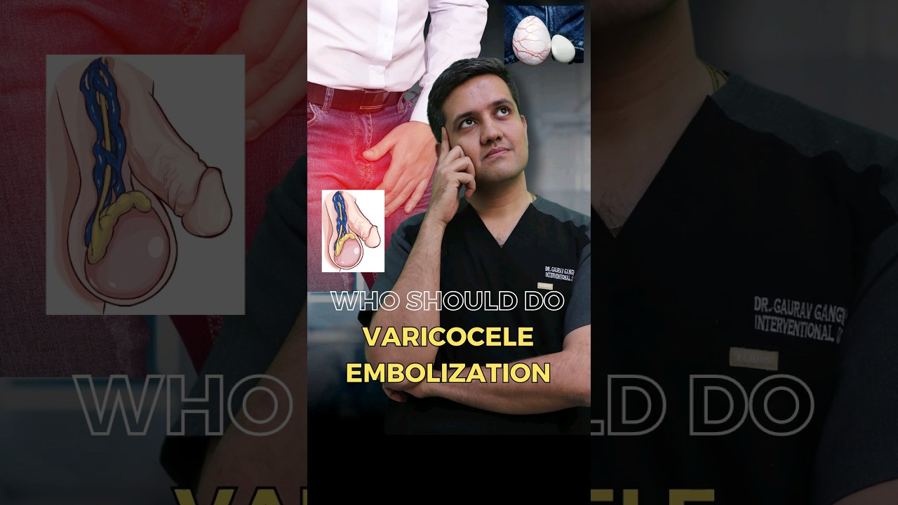Who Should Get Varicocele Embolisation Treatment?