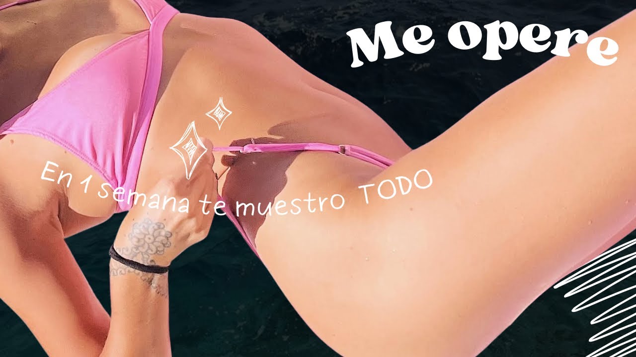 ME SEPARÉ, ME OPERÉ LAS LOLAS Y TE CUENTO TODO!