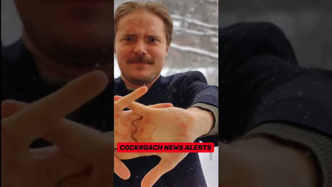 CNU. cracked his knuckles 46 times in a row #news #alerts #cnu #usa #sweden #cracked #knuckles