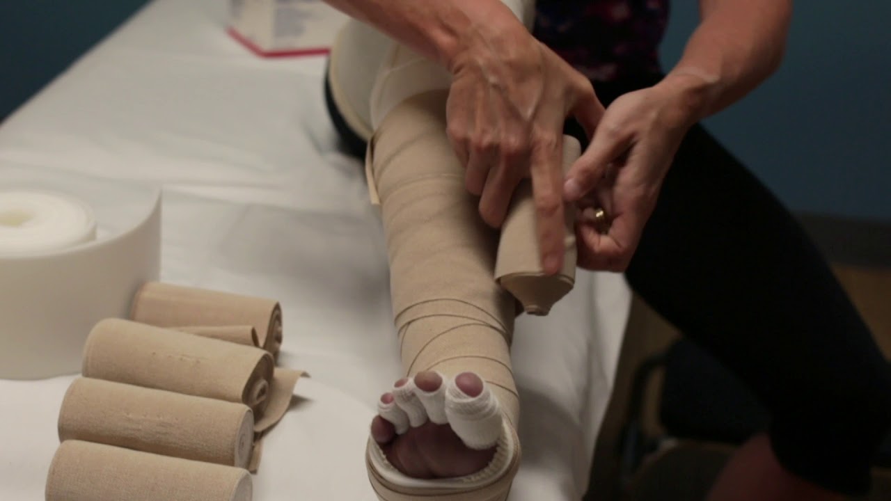 Self- Bandaging of Leg