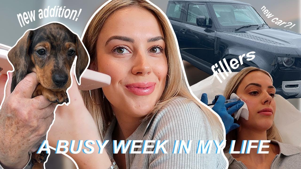 Cheek fillers, new puppy, new car | A very fun VLOG!