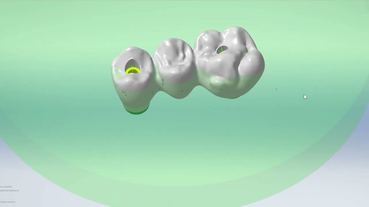 System New Ancorvis w HEXdent