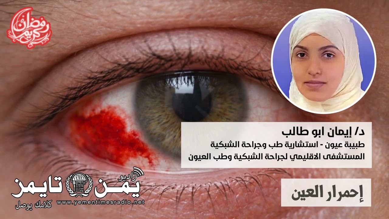 إحمرار العين وأنواعه واسبابه، ومتى يكون خطير جدا على النظر!