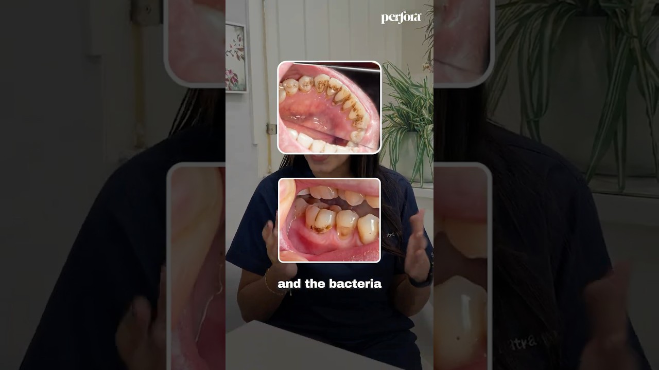 Why You NEED a Power Dental Flosser (Full Tutorial!) 💦🦷