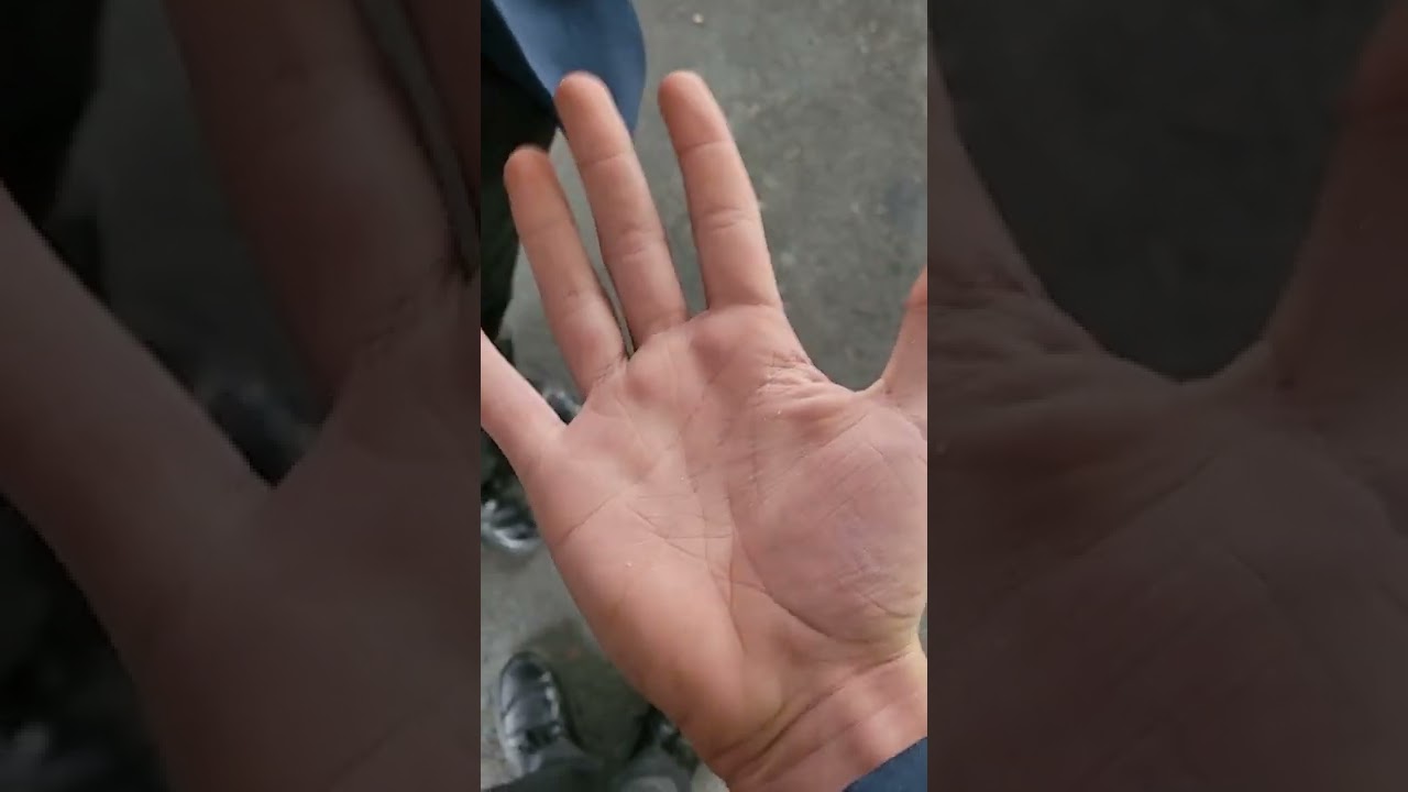 epic hand
