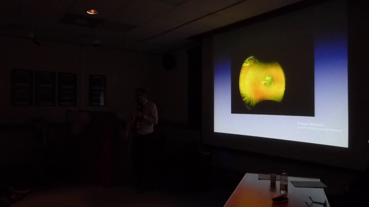 Dr Gordon Hay - Optos Widefield Camera