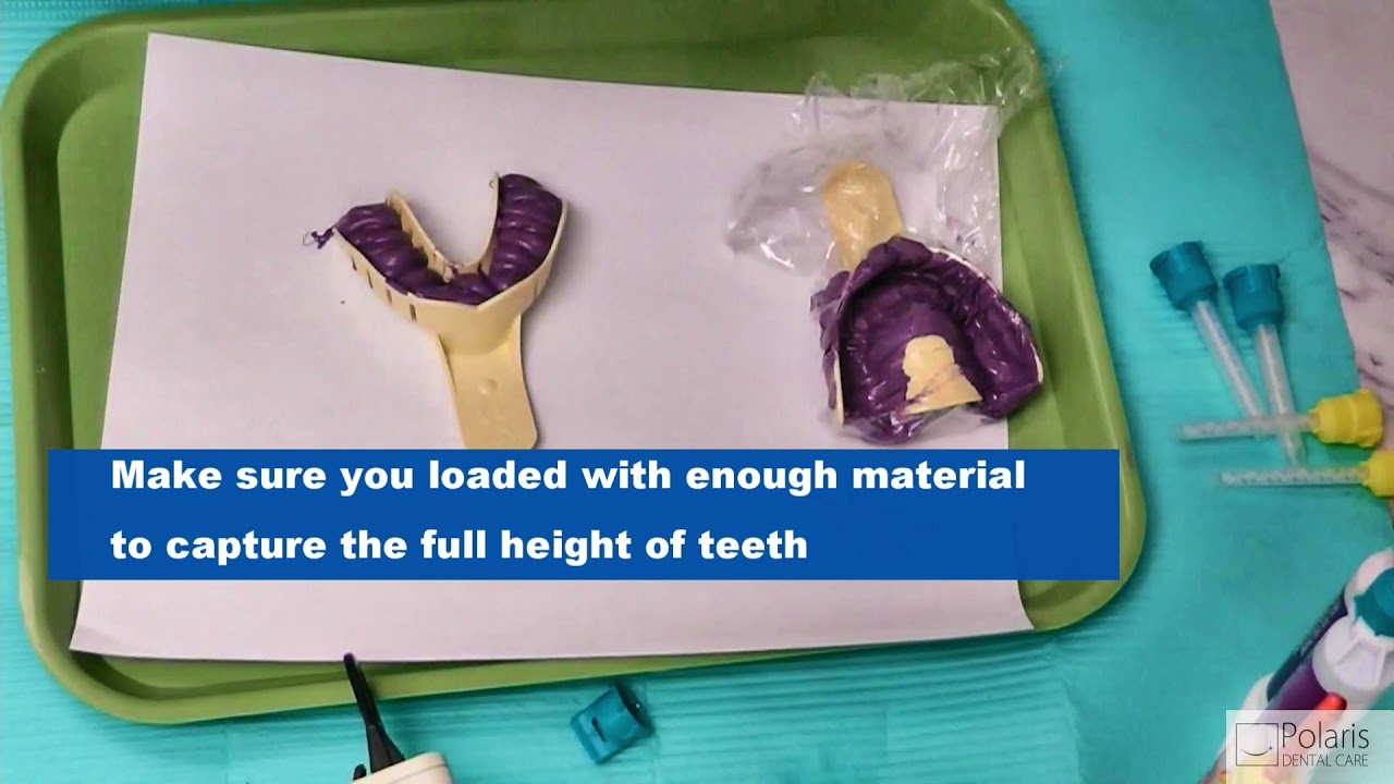 How To Take Impressions For Invisalign and Night Guards / Bite Guards