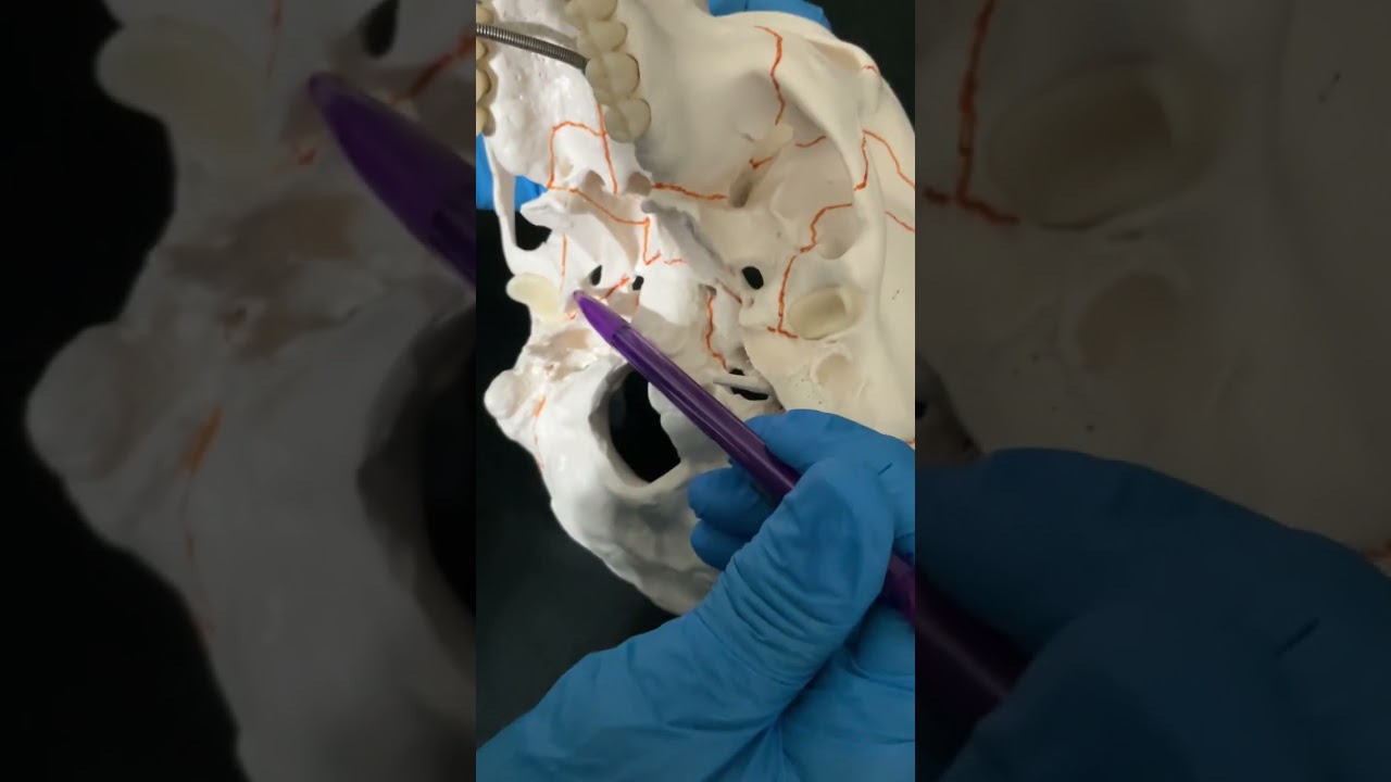 Part 2 Structures Passing Through Human Skull Foramina:  Inferior Surface