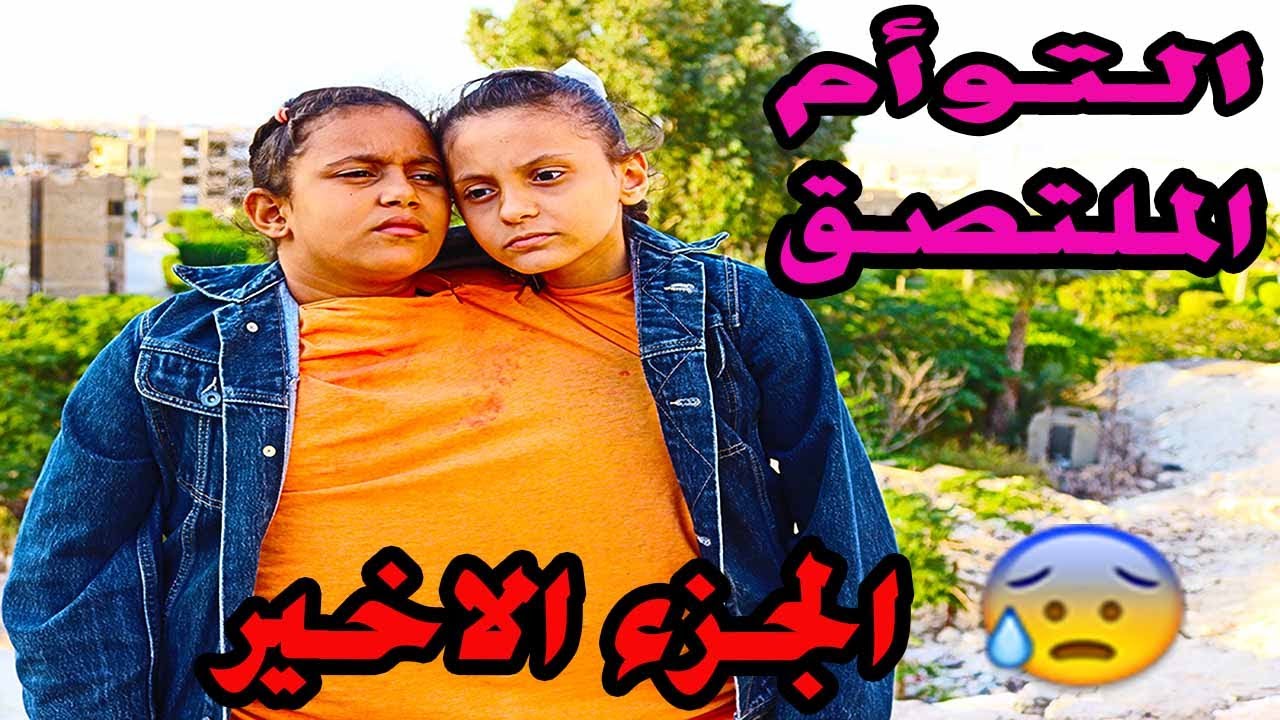 الجزء الاخير | توأم ملتصق😢