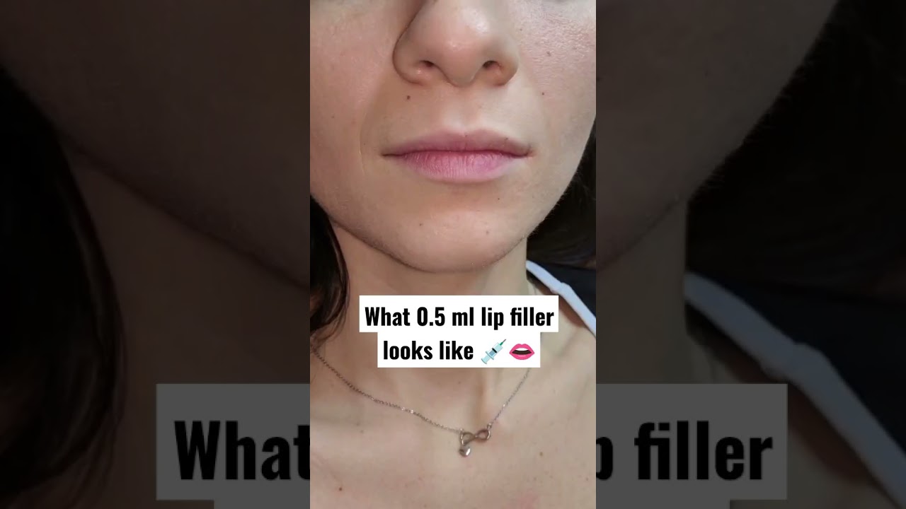 Have you ever wondered what 0.5ml of lip filler looks like? #shorts