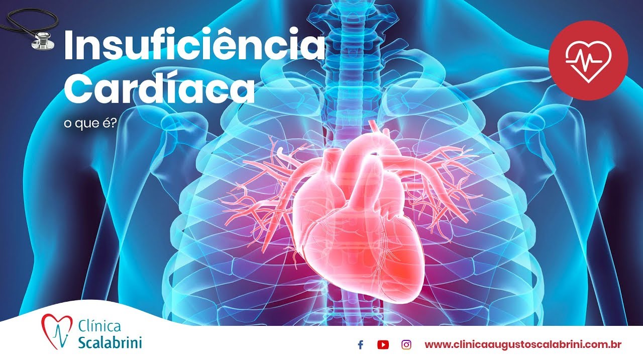 Insuficiência Cardíaca: O que é  | Por Prof. Augusto Scalabrini