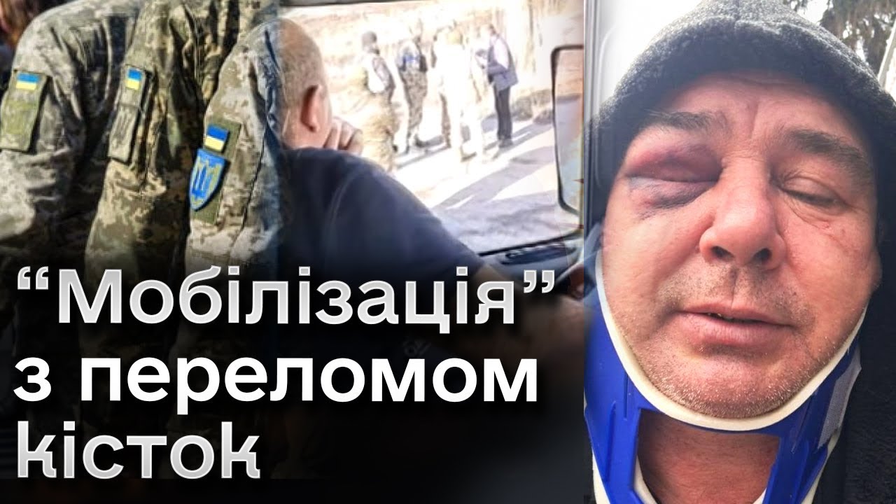 😱 На Київщині під час вручення повістки жорстоко побили чоловіка