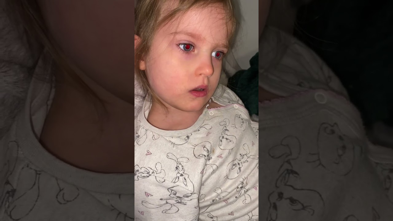 STXBP1 - Jak mogą wyglądać napady padaczkowe? How does epileptic seizures may look like