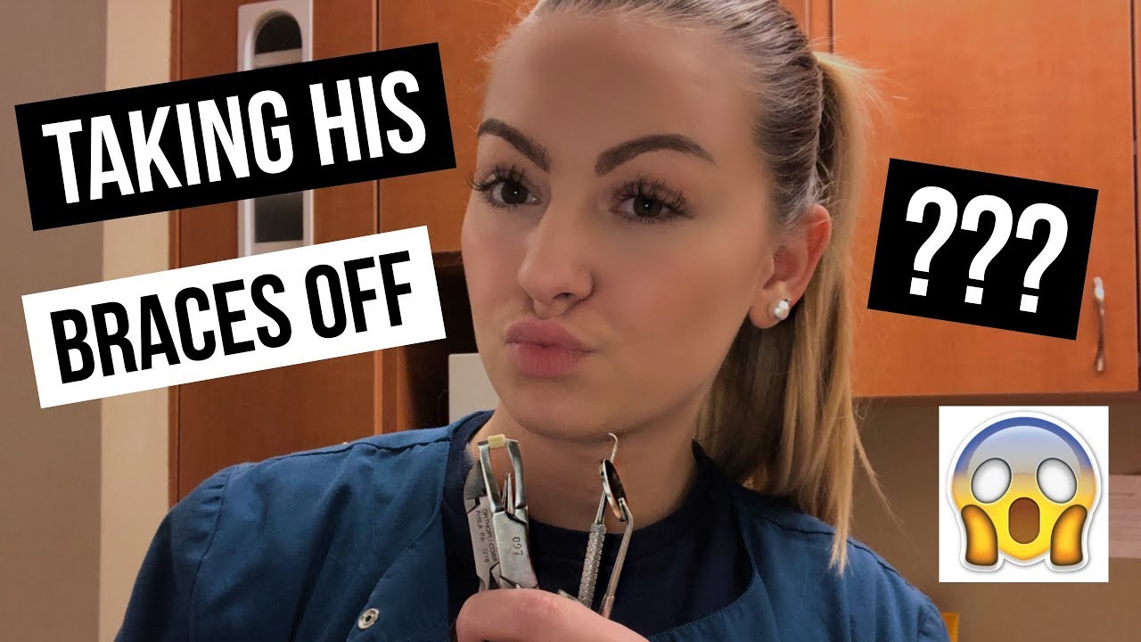 TAKING BF'S BRACES OFF || + what I ate for lunch