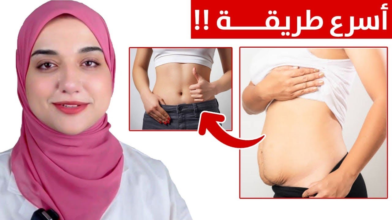 اسرع طريقة للتخلص من الكرش و ترهلات البطن السفلية بعد القيصرية و دهون البطن بعد الولادة