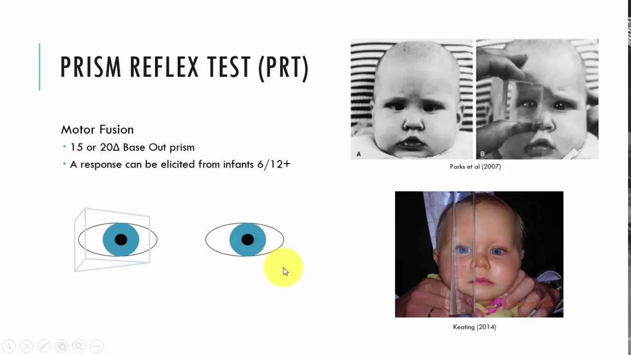Prism Reflex Test