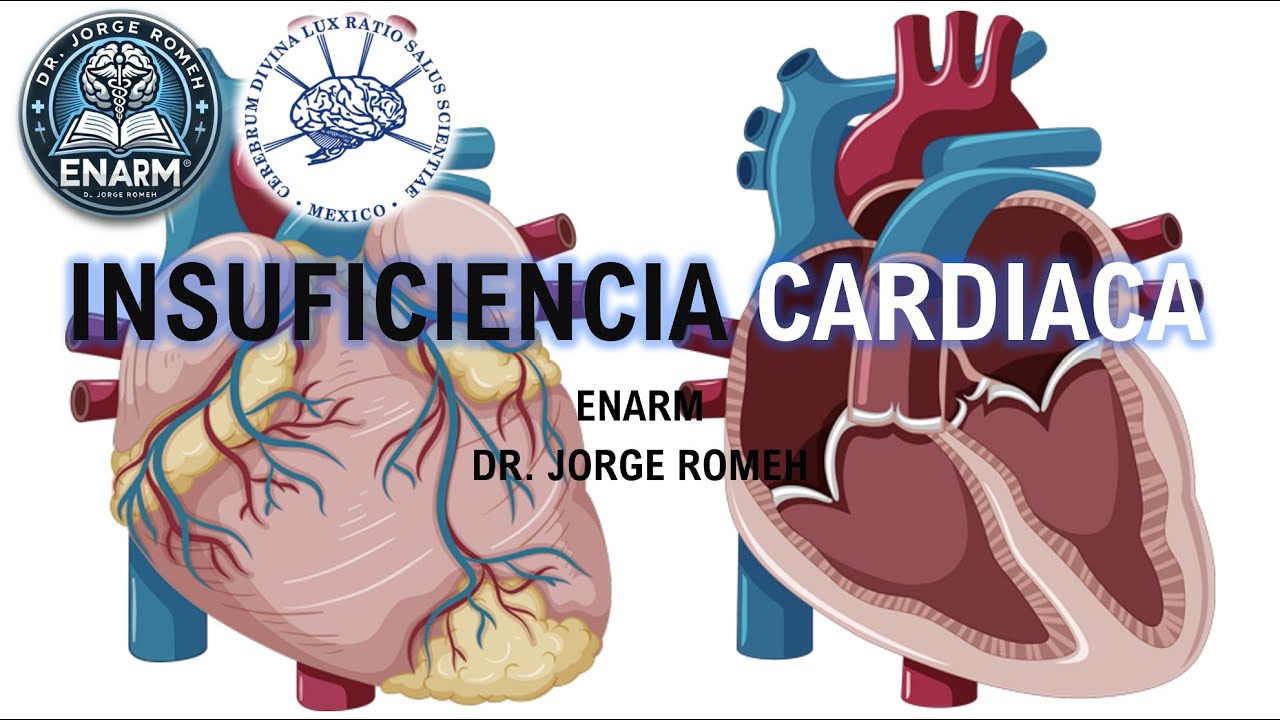 INSUFICIENCIA CARDIACA - ENARM - TODO LO QUE DEBES SABER