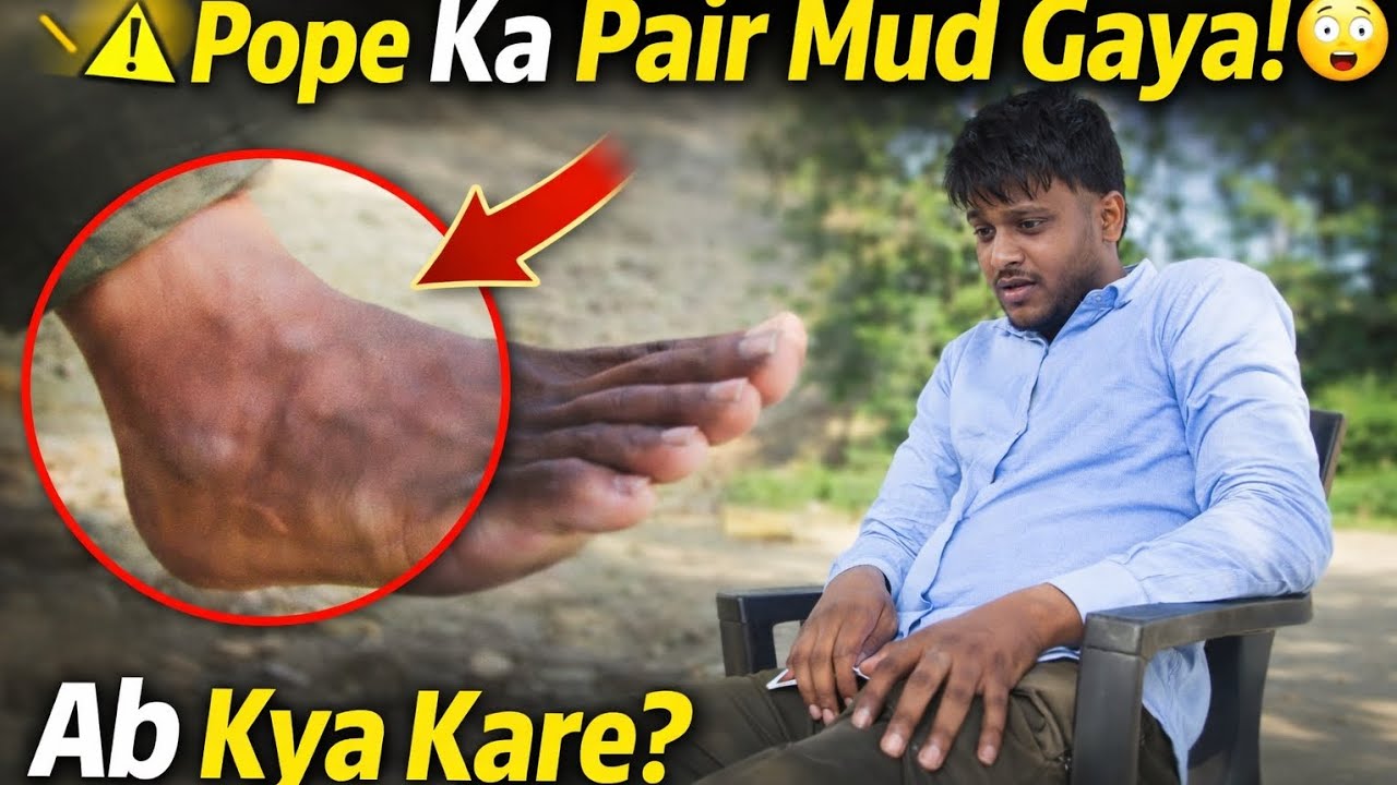 Pope Ka Pair Mud Gaya 😱 | Aaj To Problem Ho Gayi