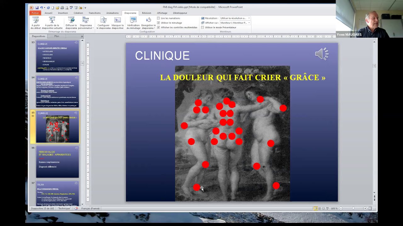 Pr MAUGARS Diagnostic de fibromyalgie