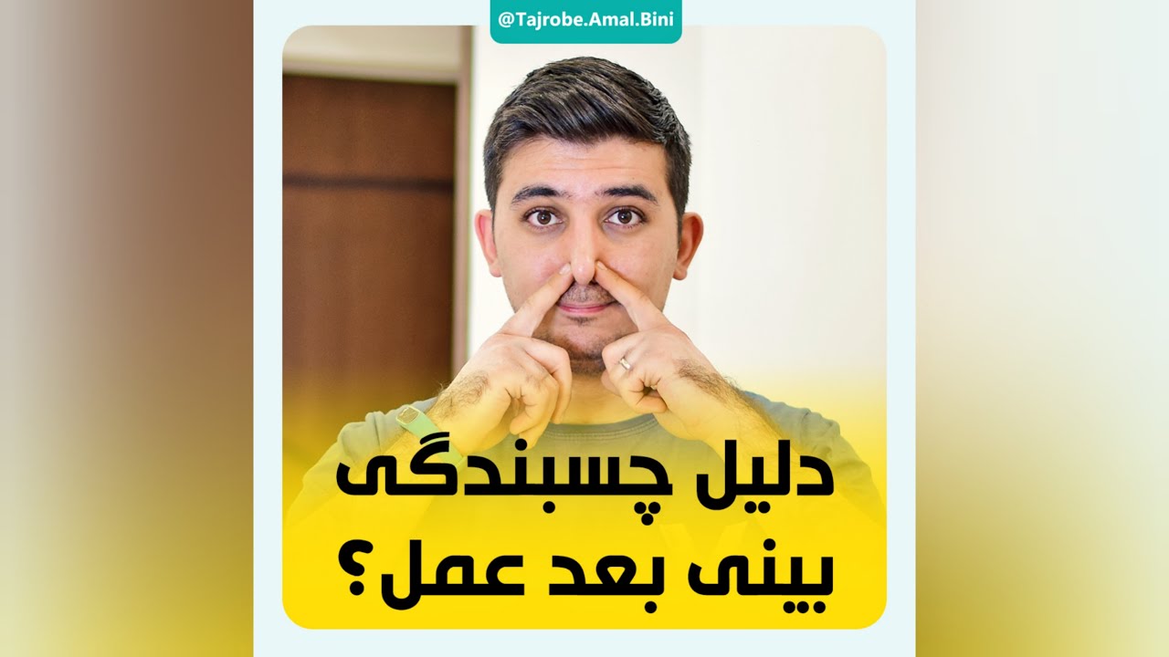 چسبندگی بینی بعد از عمل