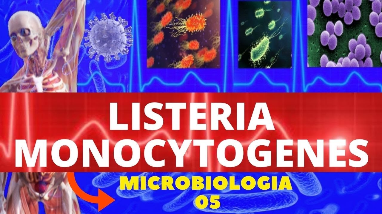 LISTERIA MONOCYTOGENES - MICROBIOLOGIA (BACTÉRIAS PATOGÊNICAS) - INFECÇÕES ALIMENTARES